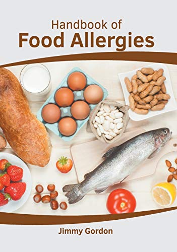 Handbook of food allergies