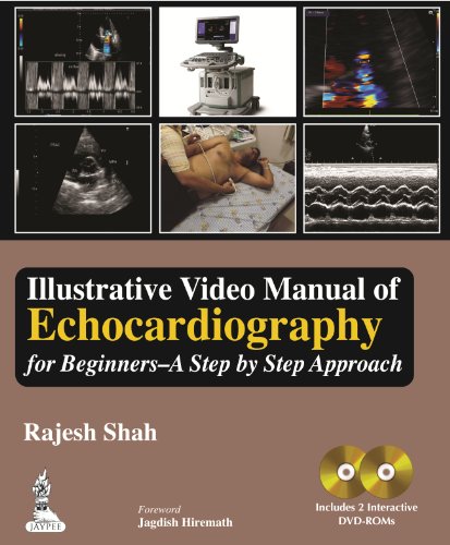 Illustrative video manual of echocardiography for beginners : a step by step approach