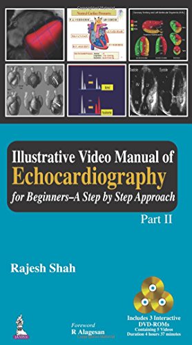 Illustrative video manual of echocardiography for beginners : a step by step approach. Pt. II.
