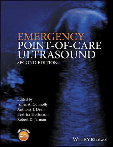 Emergency point of care ultrasound
