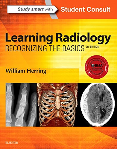 Learning radiology : recognizing the basics