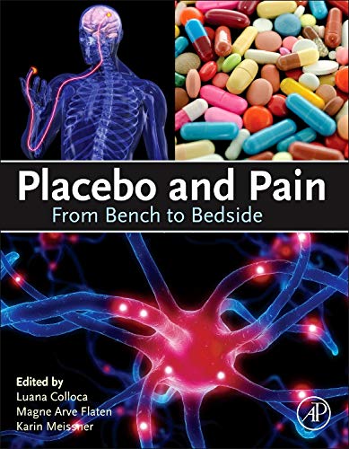 Placebo and pain : from bench to bedside