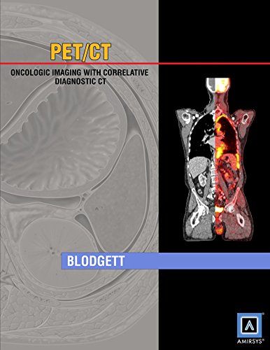PET/CT : oncologic imaging with correlative diagnostic CT
