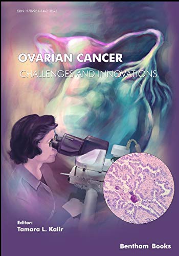Ovarian cancer : challenges and innnovations