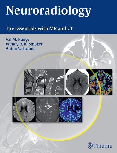 Neuroradiology : the essentials with MR and CT