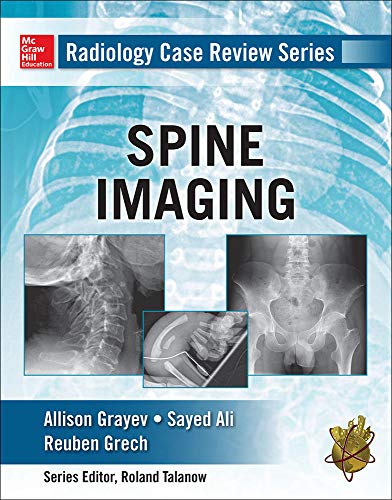 Spine imaging
