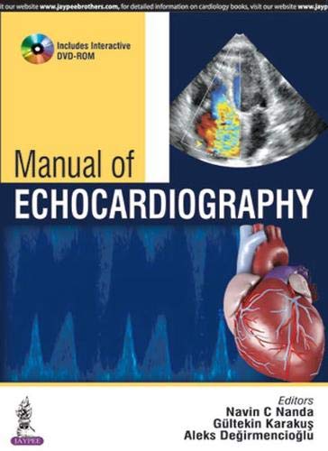 Manual of echocardiography.