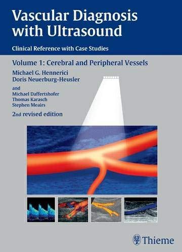 Vascular diagnosis with ultrasound : clinical reference with case studies