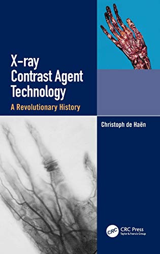 X-ray contrast agent technology : a revolutionary history