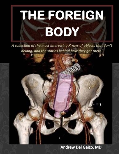 The foreign body : A collection of the most interesting X-rays of things taht don't belong and the stories behind how they got there!