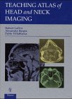 Teaching atlas of head and neck imaging