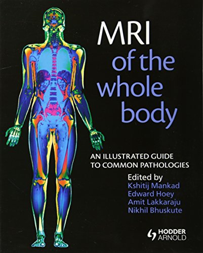 MRI of the whole body : an illustrated guide to common pathologies