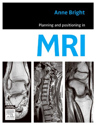 Planning and positioning in MRI