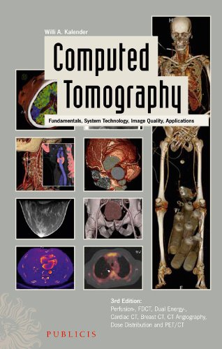 Computed tomography : fundamentals, system technology, image quality, applications