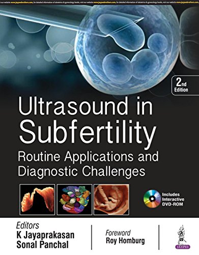 Ultrasound in subfertility : routine applications and diagnostic challenges