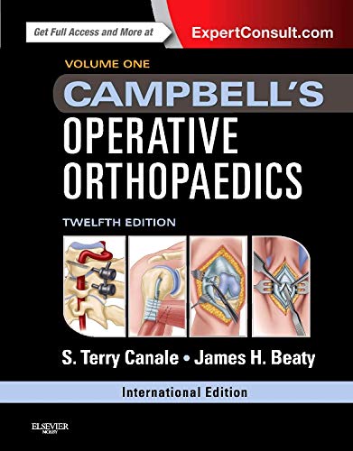 Campbell's operative orthopaedics.