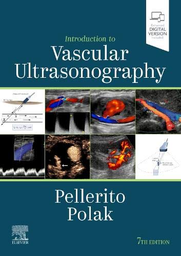 Introduction to vascular ultrasonography.