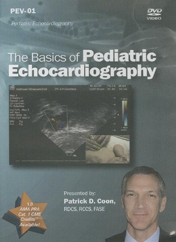 The basics of pediatric echocardiography