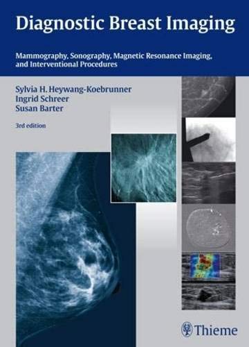 Diagnostic breast imaging : mammography, sonography, magnetic resonance imaging, and interventional procedures